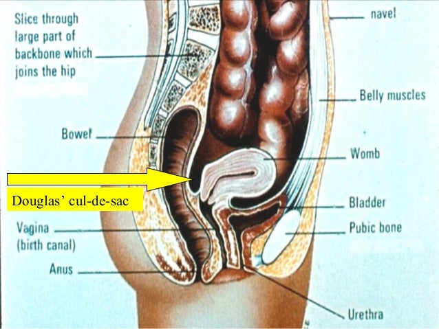 cul de sac vagina diagram Very fat mature